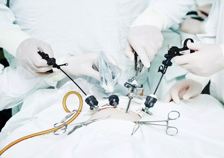 Laparoscopic Surgeries in Vijayawada at Ashwa Hospitals